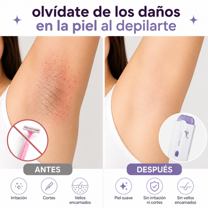 Depiladora NovaLáser Unisex